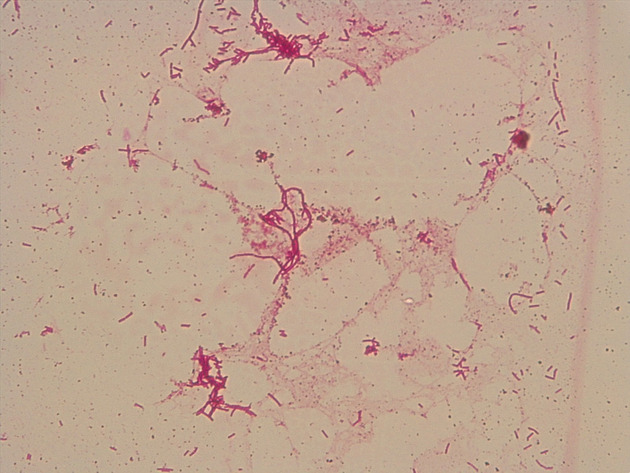Bacillus Slides - Bacillus 07 1000X